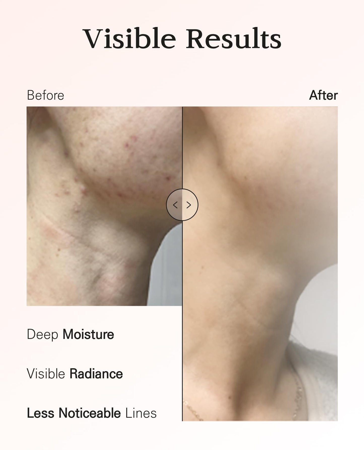 Nuborn Cell Hydrogel Collagen Neck Mask