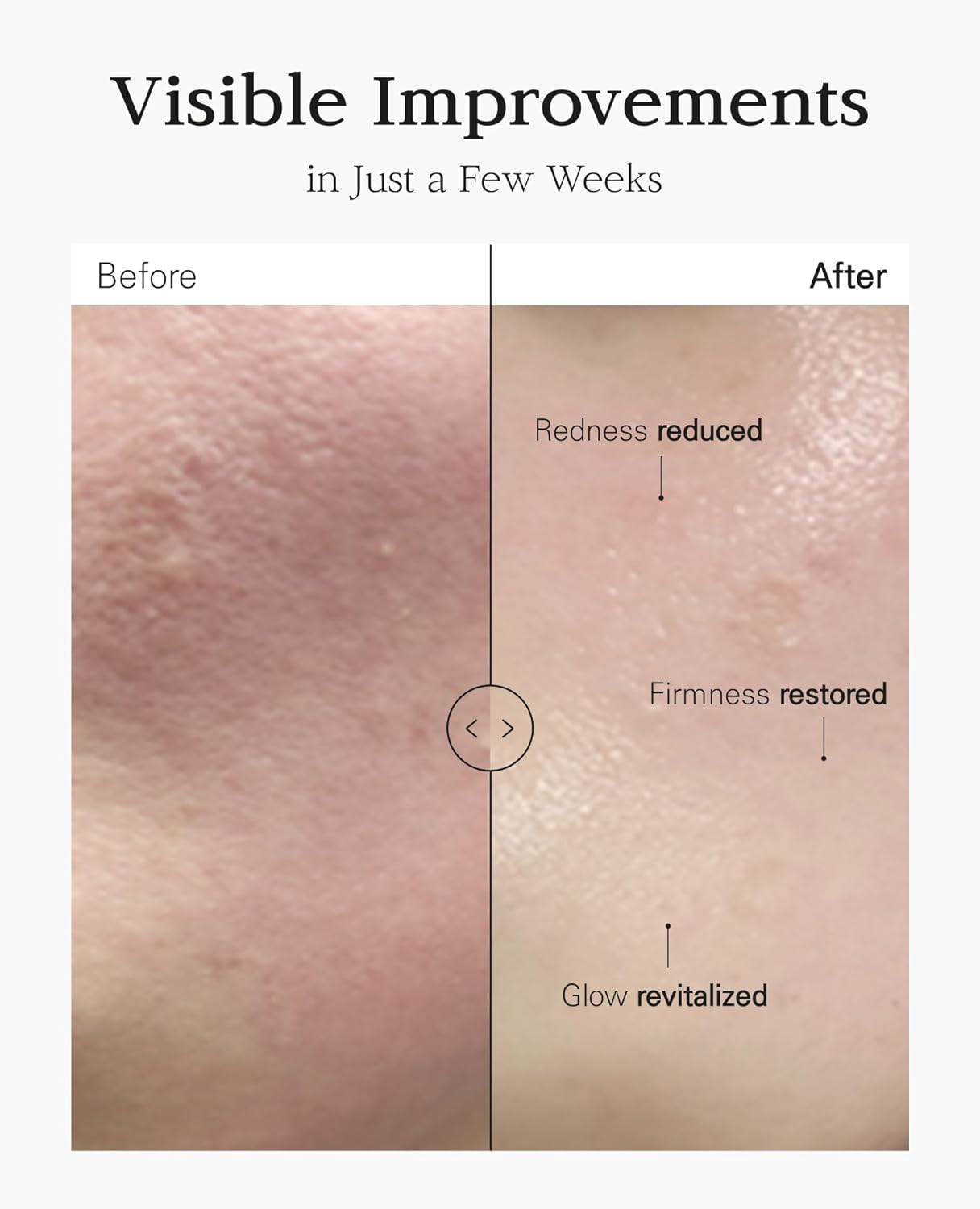 Nuborn Cell Placenta Stem Cell Intensive Repair Cream