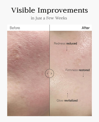 Nuborn Cell Placenta Stem Cell Intensive Repair Cream