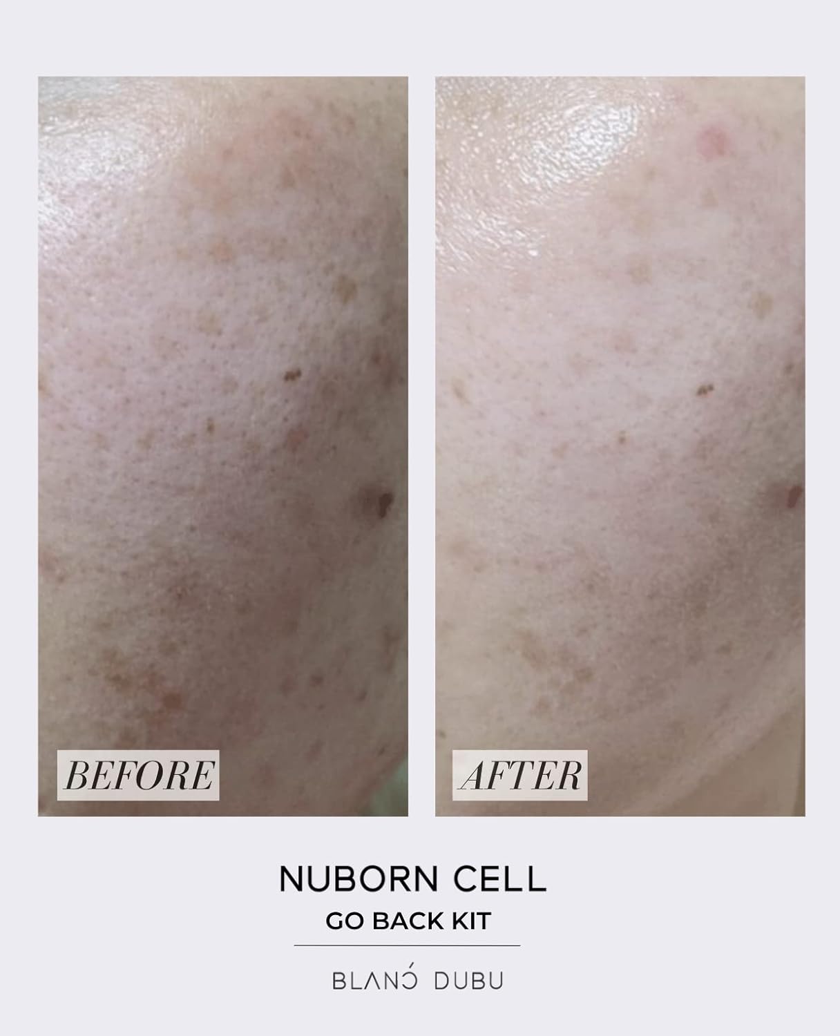 Nuborn Cell Go Back Exosome Ampoule Kit