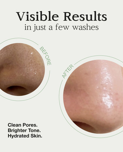 Nuborn Cell Deep Clean Spa Honey Mask